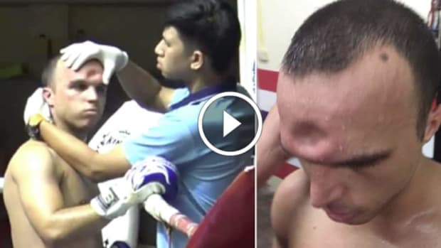 Muay Thai fighter suffers BRUTAL skull fracture from vicious elbow