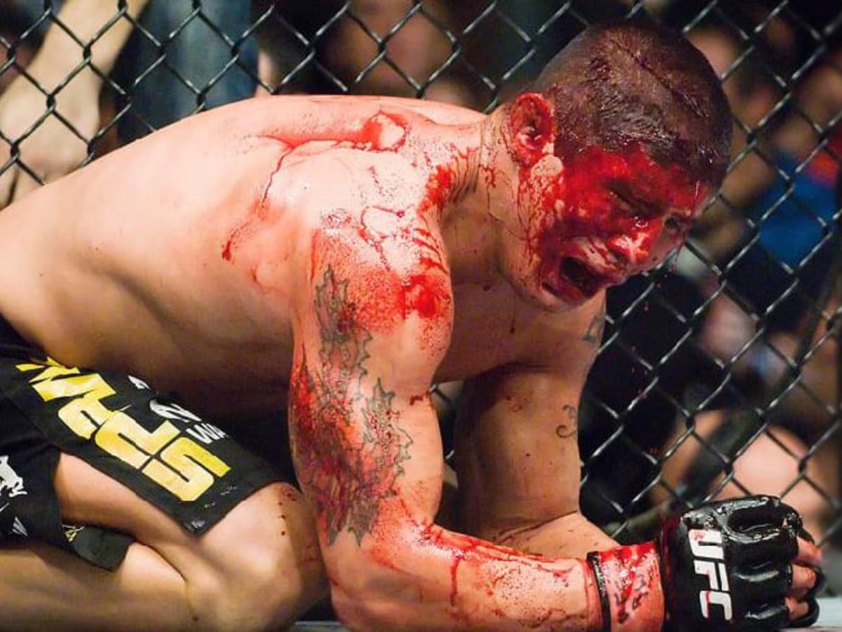 10 Bloodiest MMA Fights in History